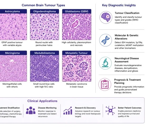 Brain Tumour & Neurological Disease