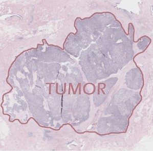 Digital Pathology AI Services