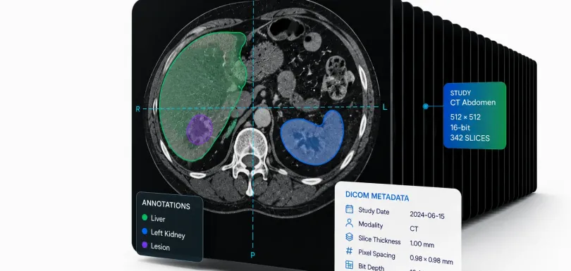 DICOM annotation visualisation showing a CT scan with organ segmentation, lesion labelling, metadata, and stacked image slices for AI training.
