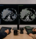 Two medical annotators review the same brain MRI scan, each outlining a suspicious region differently, illustrating disagreement in medical image annotation and inter-annotator variability.