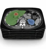 Stacked CT scan slices with colour-coded annotations highlighting anatomical structures and a lesion for radiology AI training.