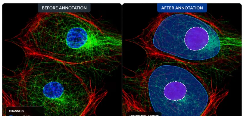 Data Annotation for Pathology AI